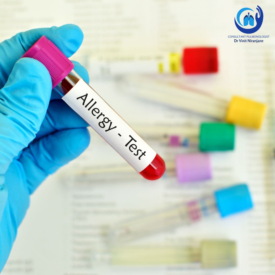 Allergy Testing | Dr. Vinit Niranjane