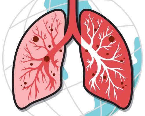 Asthma Specialist Doctor in Nagpur